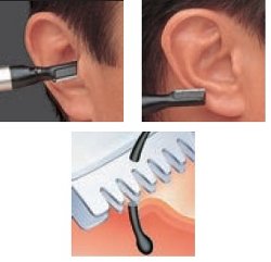 毛深い人必見 耳毛の処理方法 まとめダネ