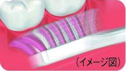歯と歯ぐきの境目もやさしく磨くソフトモード