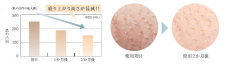 Panasonic 光エステ 光美容器 ワキ専用 白 ES-WH20-W