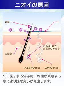 ニオイの原因