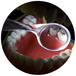 デンタルミラー