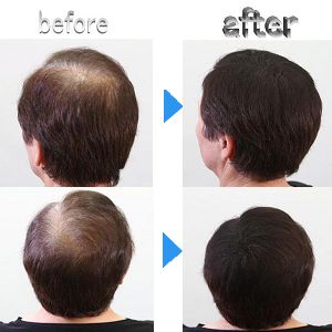 白髪染め・オシャレ