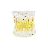 Carejoy® Dental Study Tooth Transparent Adult Pathological Teeth Model [並行輸入品]