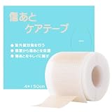 傷あとケアテープ 帝王切開 ケロイド テープ 傷あとケア用シリコンシート 傷テープ 傷隠しテープ 手術後 傷あとケア用品 4cm×150cm