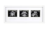 Pearhead Cadre Trimester Sonogram, Deluxe