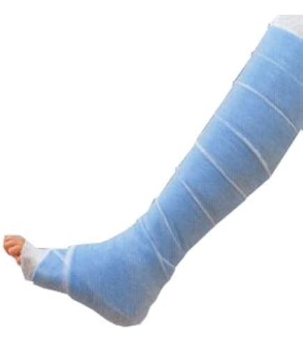 医療用ギプス　フルセット Amazon.co.jp: アルケア オルテックス ギプス用包帯 10221 青2裂 12巻