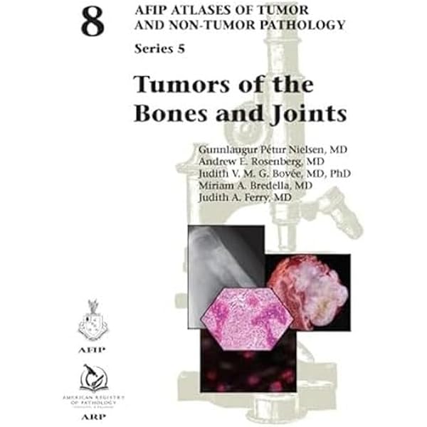 AFIP4th #14 Tumors of the Prostate(新本) AFIP4th #14 Tumors of the Prostate(新本)