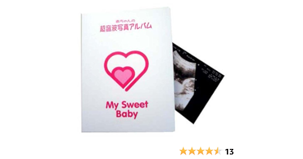 Amazon Co Jp ディンドン 超音波写真アルバムmy Sweet Baby 10ポケット 白 0003 家電 カメラ