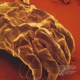 �C���t�����b�h�E���C�f�B���O�E�t�b�h