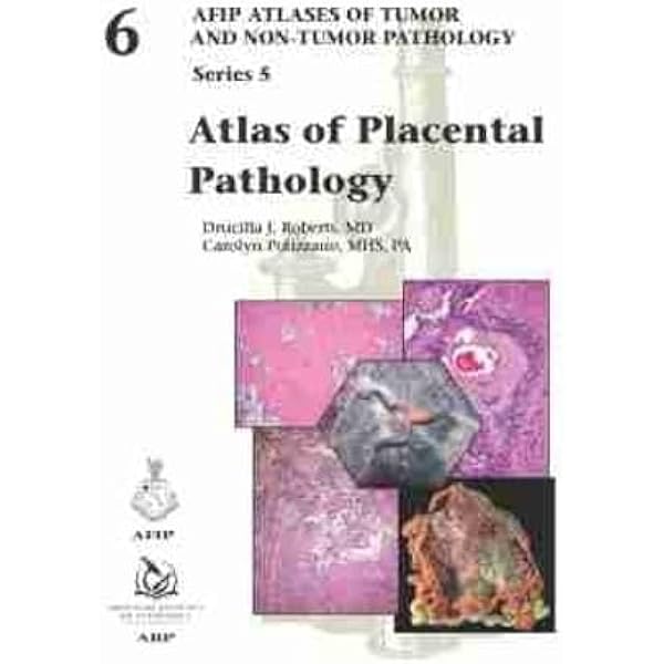 Amazon | Tumors of the Prostate Gland, Seminal Vesicles