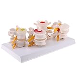 Kesoto 高品質　人体解剖学用　腰椎　脊柱像モデル　シミュレーション　人間　モデル　PVC製