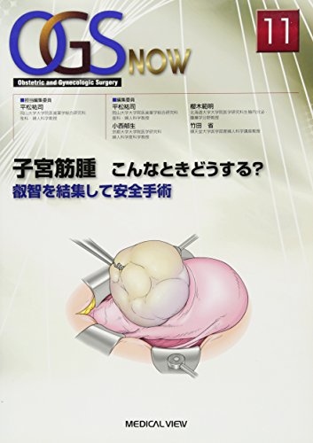 子宮筋腫 こんなときどうする? (OGS NOW No. 11) 子宮筋腫 こんなときどうする? (OGS NOW No. 11)