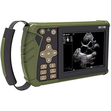 Amazon.co.jp 売れ筋ランキング: 医療用超音波診断装置 の中で最も人気