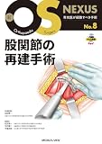 股関節の再建手術［Web動画付］ (新OS NEXUS No.8)