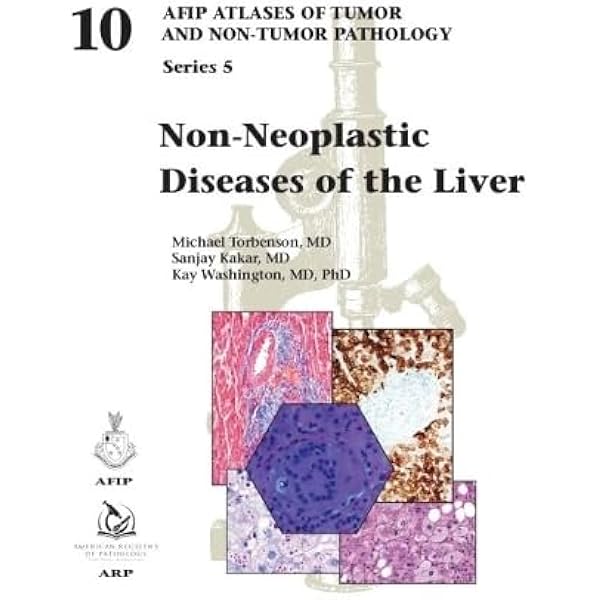 Amazon | Tumors of the Salivary Glands (AFIP Atlas of Tumor and