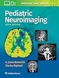 Pediatric Neuroimaging