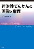 難治性てんかんの画像と病理