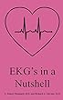 EKG's in a Nutshell (English Edition)