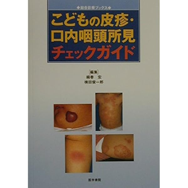 アトラスさくま―小児咽頭所見 | 佐久間 孝久 |本 | 通販 | Amazon