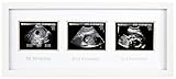 Pearhead Photo Frame, Triple Sonogram by Pearhead [並行輸入品]