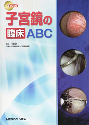 子宮鏡の臨床ABC 子宮鏡の臨床ABC