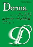 エリテマトーデスを診る (MB Derma(デルマ))