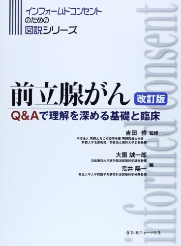 前立腺がん―Q&Aで理解を深める基礎と臨床 (インフォームドコンセントの 前立腺がん―Q&Aで理解を深める基礎と臨床 (インフォームドコンセントの
