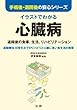 イラストでわかる心臓病