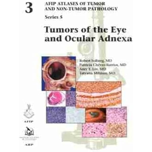 Amazon | Tumors of the Prostate Gland, Seminal Vesicles