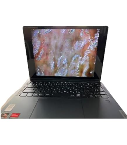 Amazon.co.jp: 血流スコープ 毛細血管顕微鏡 9インチモニター ゴースト