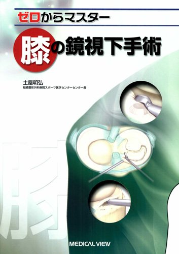 膝の鏡視下手術 (ゼロからマスター) 膝の鏡視下手術 (ゼロからマスター)