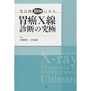 発見例100例にみる胃癌X線診断の究極 発見例100例にみる胃癌X線診断の究極