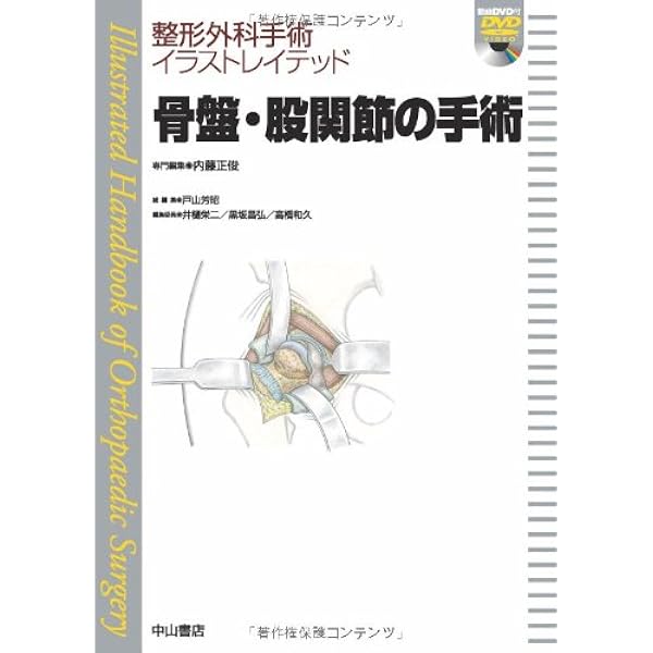骨盤 股関節の手術 Dvd付 整形外科手術イラストレイテッド 内藤正俊 戸山芳昭 本 通販 Amazon