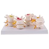 Fenteer 人間腰椎　脊柱像 　模型　プロフェッショナル　医学教育研究用　高品質