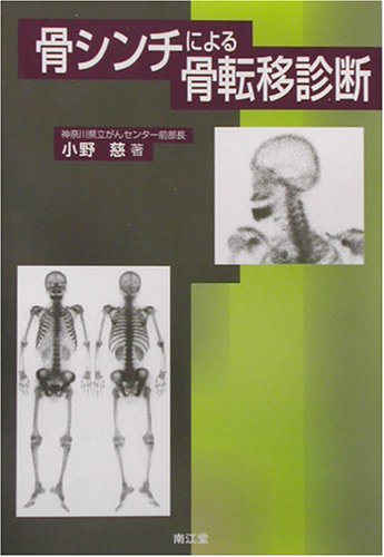 骨シンチによる骨転移診断 骨シンチによる骨転移診断