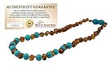 Baltic Amber Teething Necklace for Babies (Unisex) (Honey Multi Cherry Black Red Milk White Butter Y