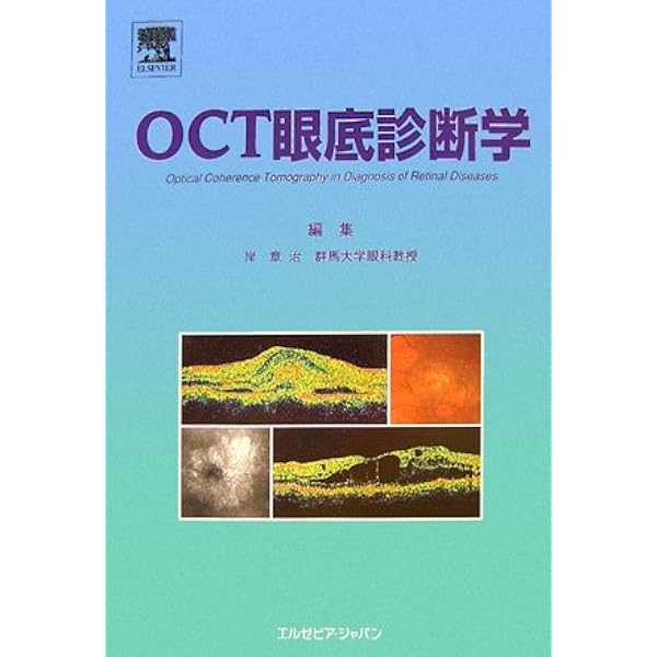 【値引交渉可】(サイン付き)OCT眼底診断学 第2版 Amazon.co.jp: OCT眼底診断学 第3版 : 岸 章治: 本