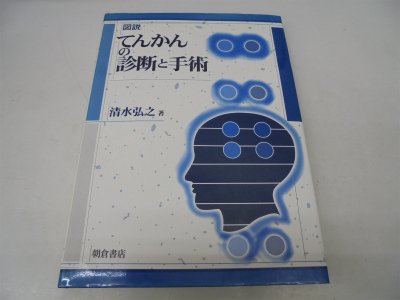 図説 てんかんの診断と手術 図説 てんかんの診断と手術