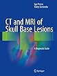 CT and MRI of Skull Base Lesions: A Diagnostic Guide
