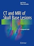 CT and MRI of Skull Base Lesions: A Diagnostic Guide