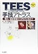 TEES (経外耳道的内視鏡下耳科手術)手技アトラス