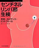 センチネルリンパ節生検: 手技・エビデンス・ピットフォ-ル