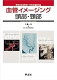 血管イメージング頭部・頸部