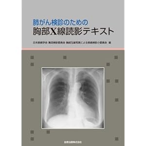 肺がん検診のための胸部X線読影テキスト 肺がん検診のための胸部X線読影テキスト
