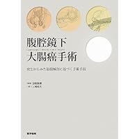 イラストレイテッド大腸癌手術 : 膜解剖にもとづく剥離のベストテクニック イラストレイテッド大腸癌手術: 膜解剖にもとづく剥離のベスト