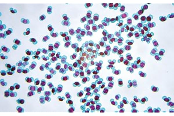 ケニス 花粉 プレパラート 10種各1枚 1 157 0100 花粉を顕微鏡観察しよう 顕微鏡 おもちゃ Amazon