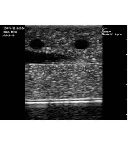 Amazon.co.jp: 超音波ガイド下穿刺トレーニングゲル UGP-GEL F 高輝度