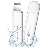 IFLYウォーターピーリング 毛穴 汚れ除去 ピーリング フェースクレンジング 美容器 黒ずみ 角栓取れ 超音波 イオン導入 イオン導出