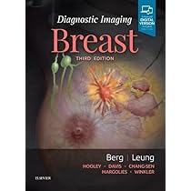 Breast Ultrasound - Stavros Rapp Parker | 9780397516247