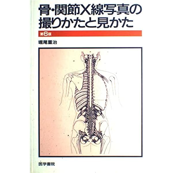 新版 骨関節のX線診断 Amazon.co.jp: 新版 骨関節のX線診断 : 江原 茂: 本